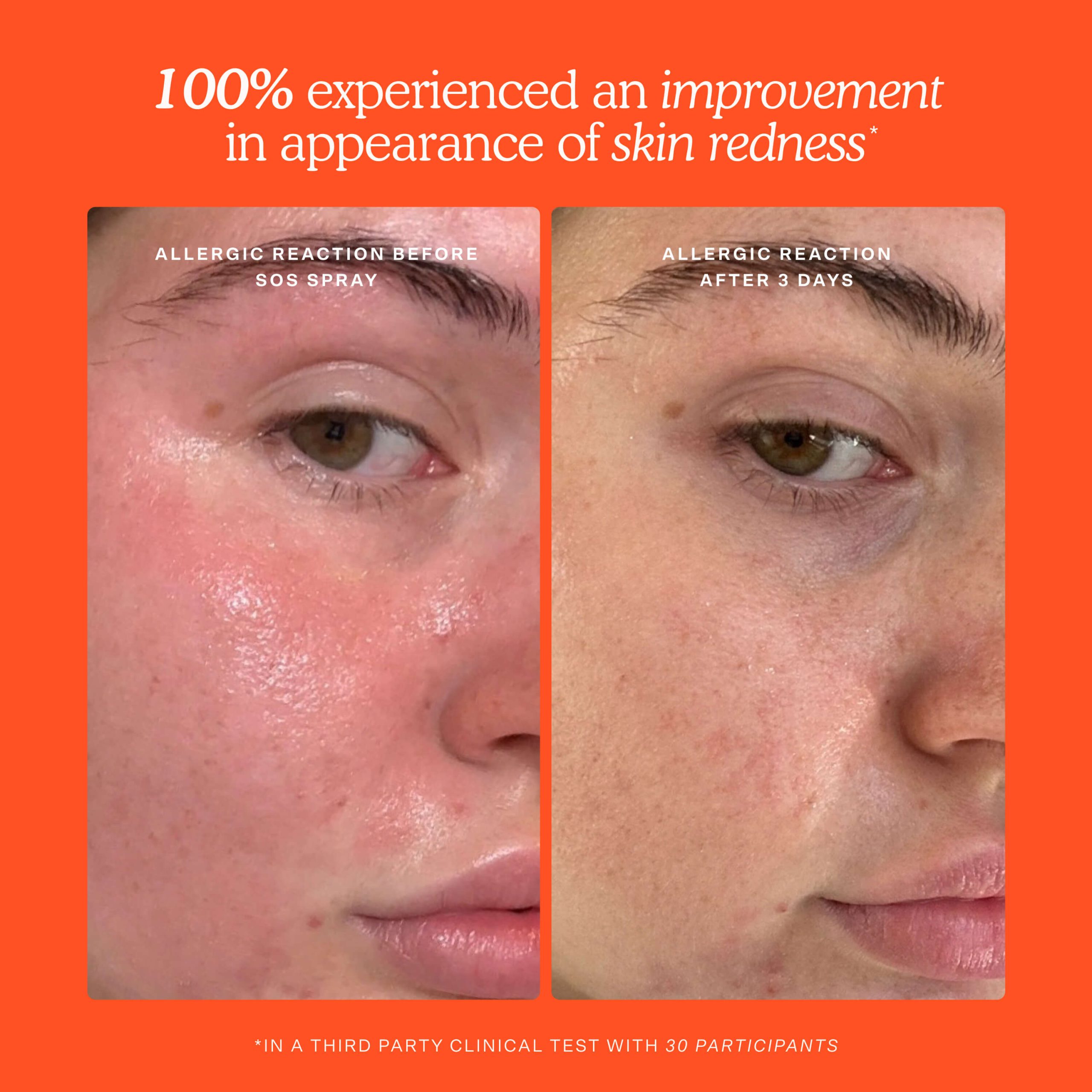 SOS Skincare Minis Kit - 图片 4